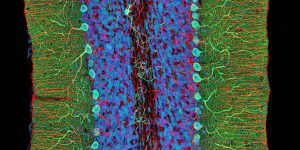 ZEISS Microscopy, Thomas Deerinck