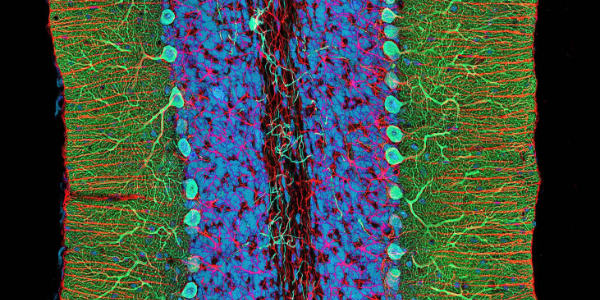 LA SOMBRA COLECTIVA EN LA ENCRUCIJADA BÉLICA DE 2026